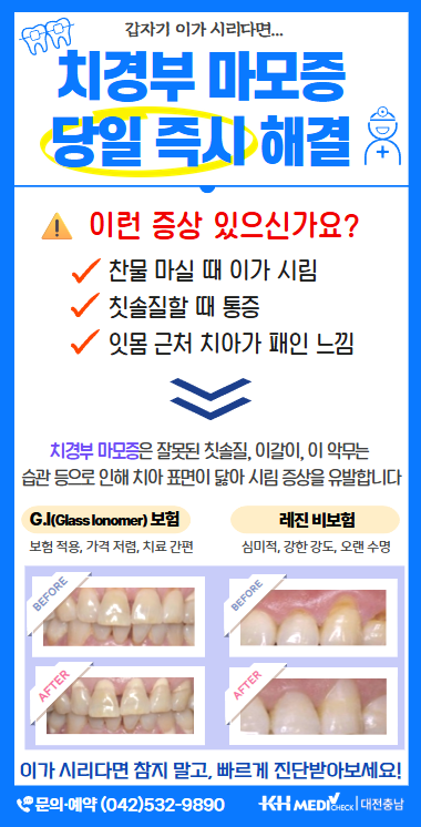 치경부마모증